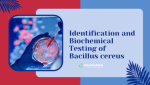 Identifying Bacillus Anthracis: A Guide to Biochemical Testing