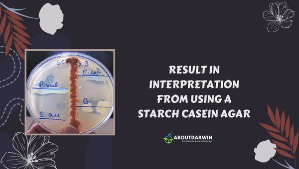 Result in Interpretation from Using a Starch Casein Agar