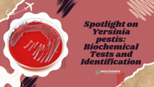 Unveiling Yersinia Pestis: History, Symptoms, and Prevention