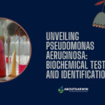 Stay Informed About Pseudomonas aeruginosa and Its Dangers