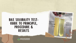 Bile Solubility Test- Guide to Principle, Procedure & Results