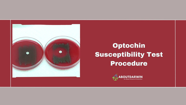 Optochin Susceptibility Test Procedure