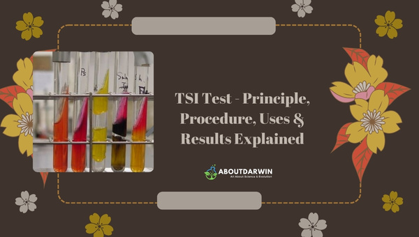 TSI Test - Principle, Procedure, Uses & Results Explained