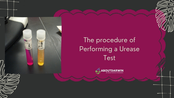 The procedure of Performing a Urease Test