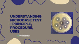 Understanding Microdase Test