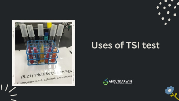 Uses of TSI test
