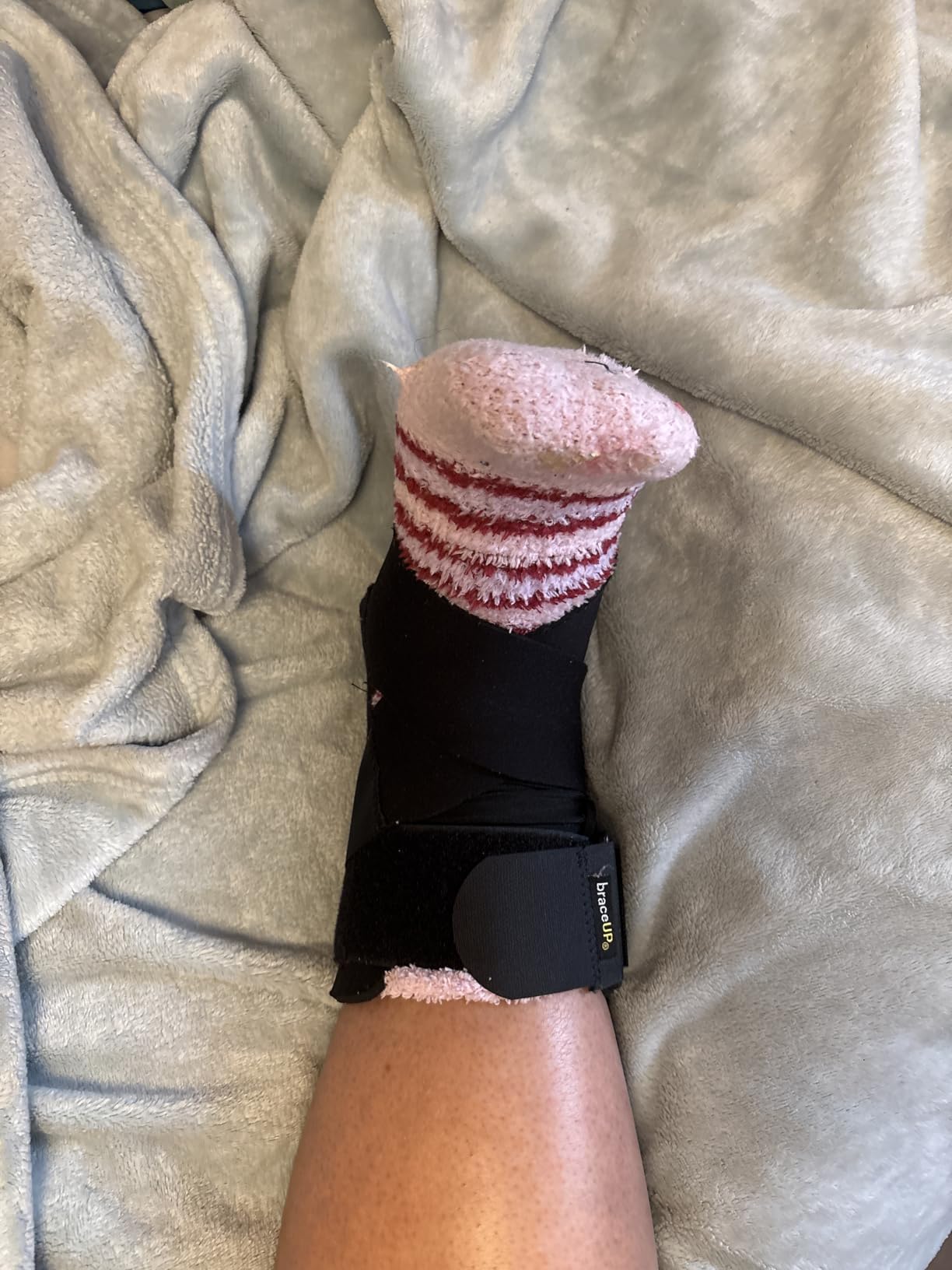 BraceUP Ankle Brace - Relieve Pain, Enhance Stability for Foot Pain, Sprained Ankle, Achilles Tendonitis, Men and Women customer photo 1