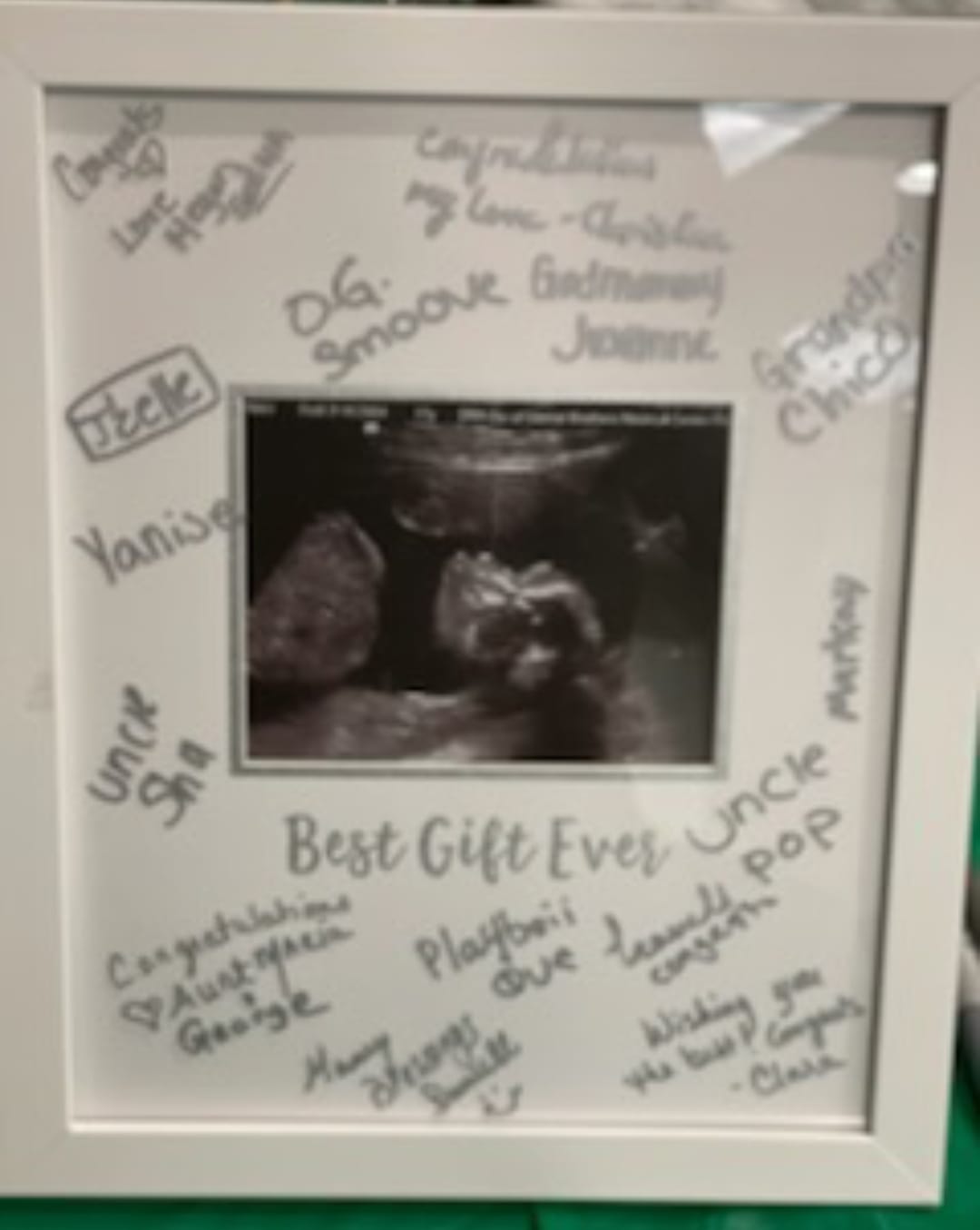 Sonogram Signature Frame - Ultrasound Picture Keepsake, Gender Neutral Baby Shower Decor, First Time Moms Pregnancy Gift, Guest Book Alternative, Ideal for Nursery, Marker Included | Includes Silver Marker, Holds 4
