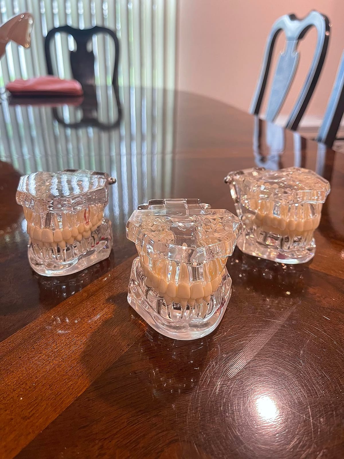 Ultrassist Transparent Dental Disease Teeth Model with Removable Teeth | Dental Pathology Demonstration Model for Dentist Patient Education & Teaching customer photo 2