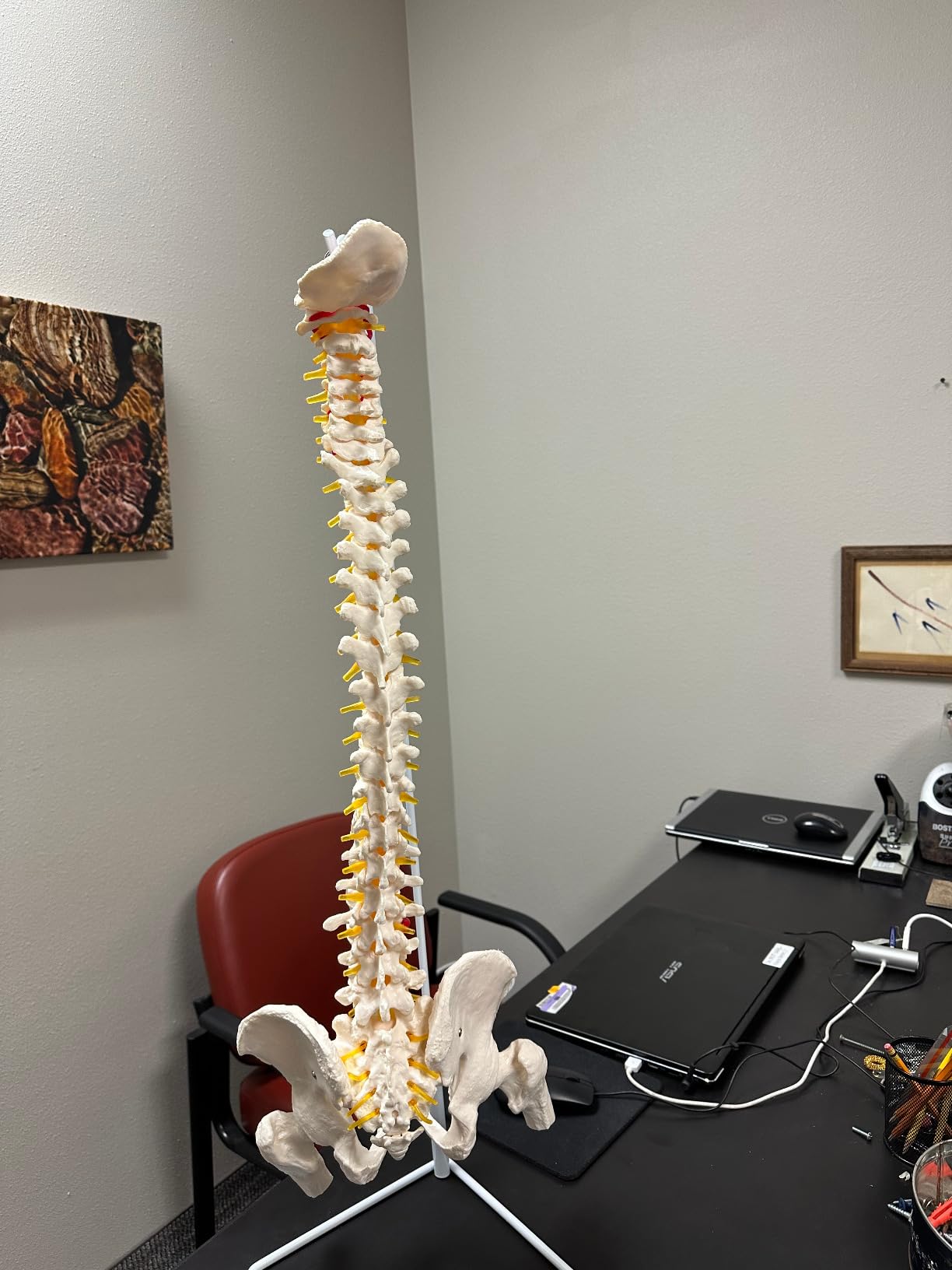 breesky Spine Model, 34.6