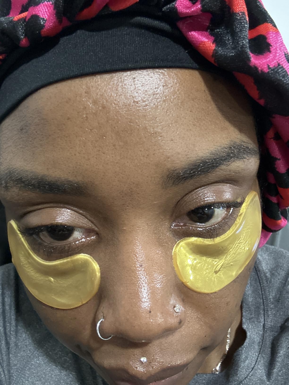 CHMI 24K Gold Under Eye Patches 50 Pairs Collagen, Dark Circles, Wrinkles | Puffy looking eyes, collagen skin care, hydrating eye mask, hydrogel, hyaluronic acid, vitamin E, men & women, travel, gift customer photo 2