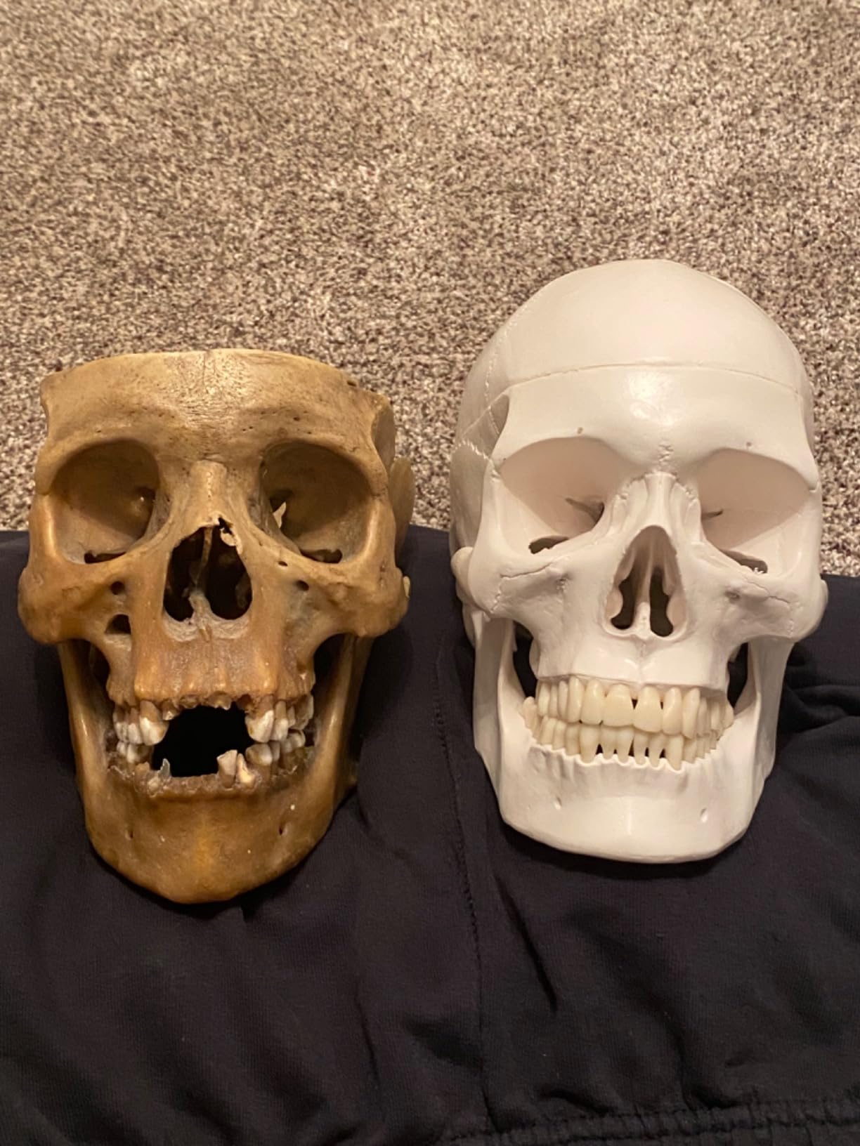 Axis Scientific Human Skull Model for Anatomy Life Size customer photo 1