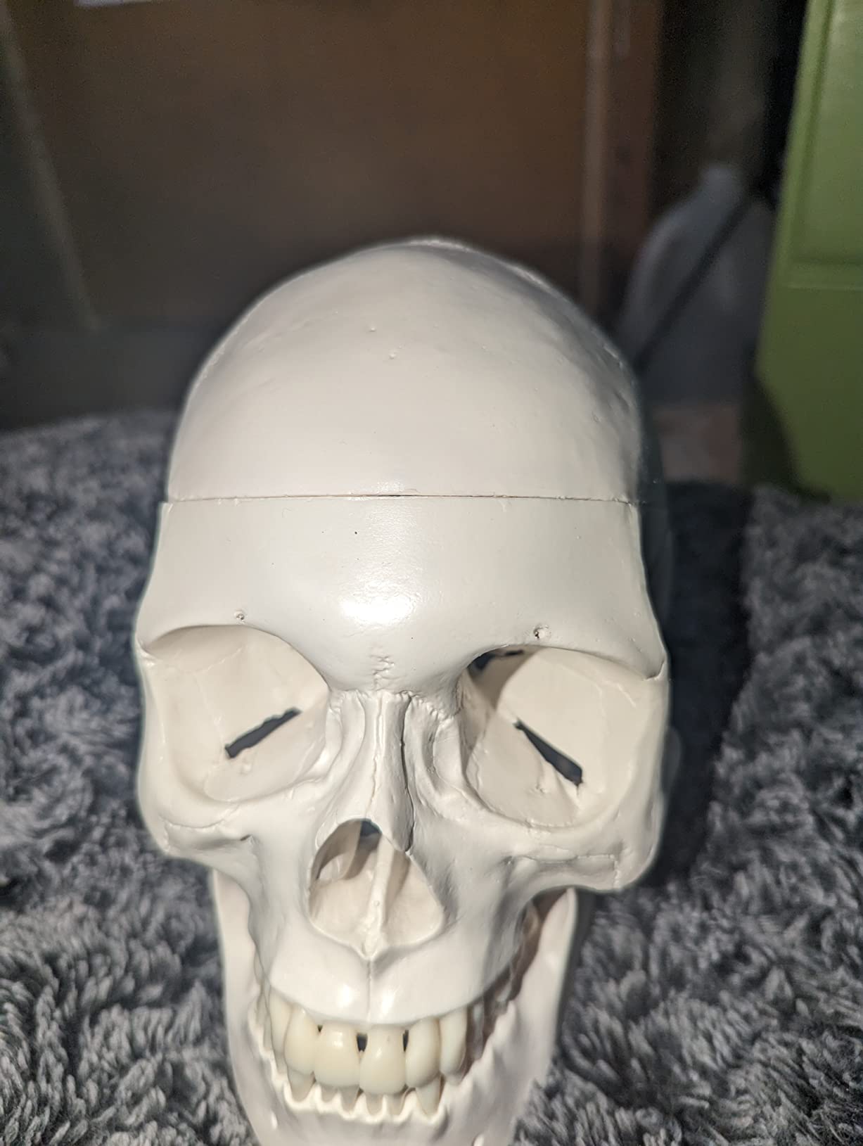 Axis Scientific Human Skull Model for Anatomy Life Size customer photo 2