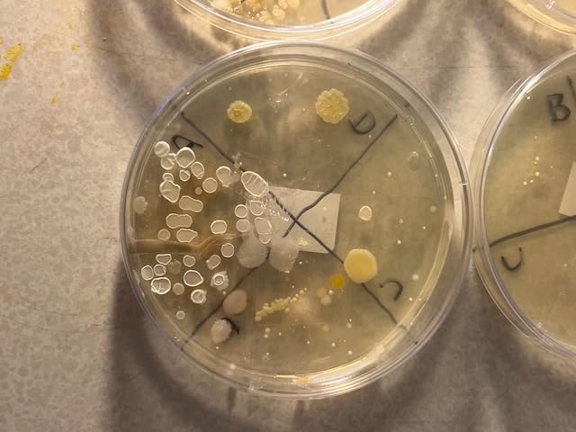 Bacteria Science Kit (IV): Top Science Fair Project Kit. Prepoured LB-Agar Plates And Cotton Swabs. Exclusive Free Science Fair Project E-Book Packed With Award Winning Experiments (IV) customer photo 1