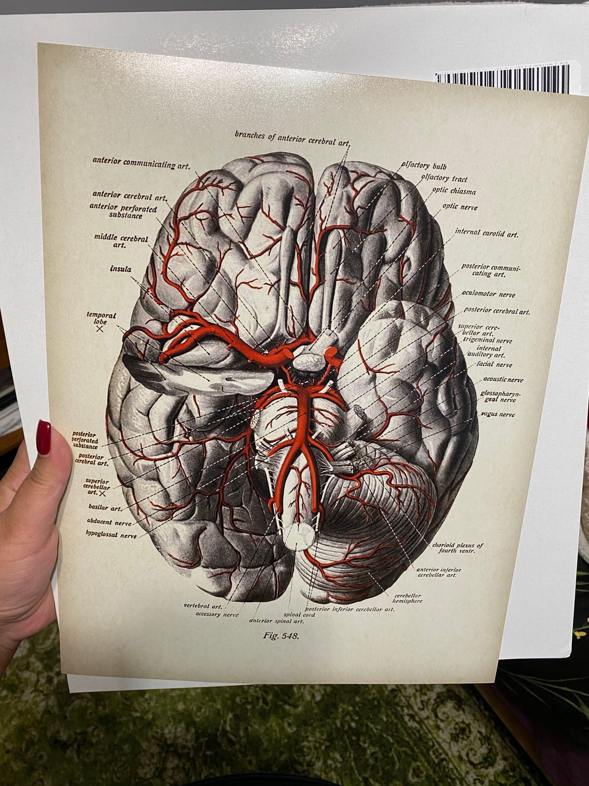 Brain with Blood Vessels and Nerves Anatomy 11x14 Unframed Print - Medical Illustration, Brain Poster, Neuroanatomy Vintage Artwork, Educational Brain Diagram for Office, Clinic & Classroom Decor customer photo 1