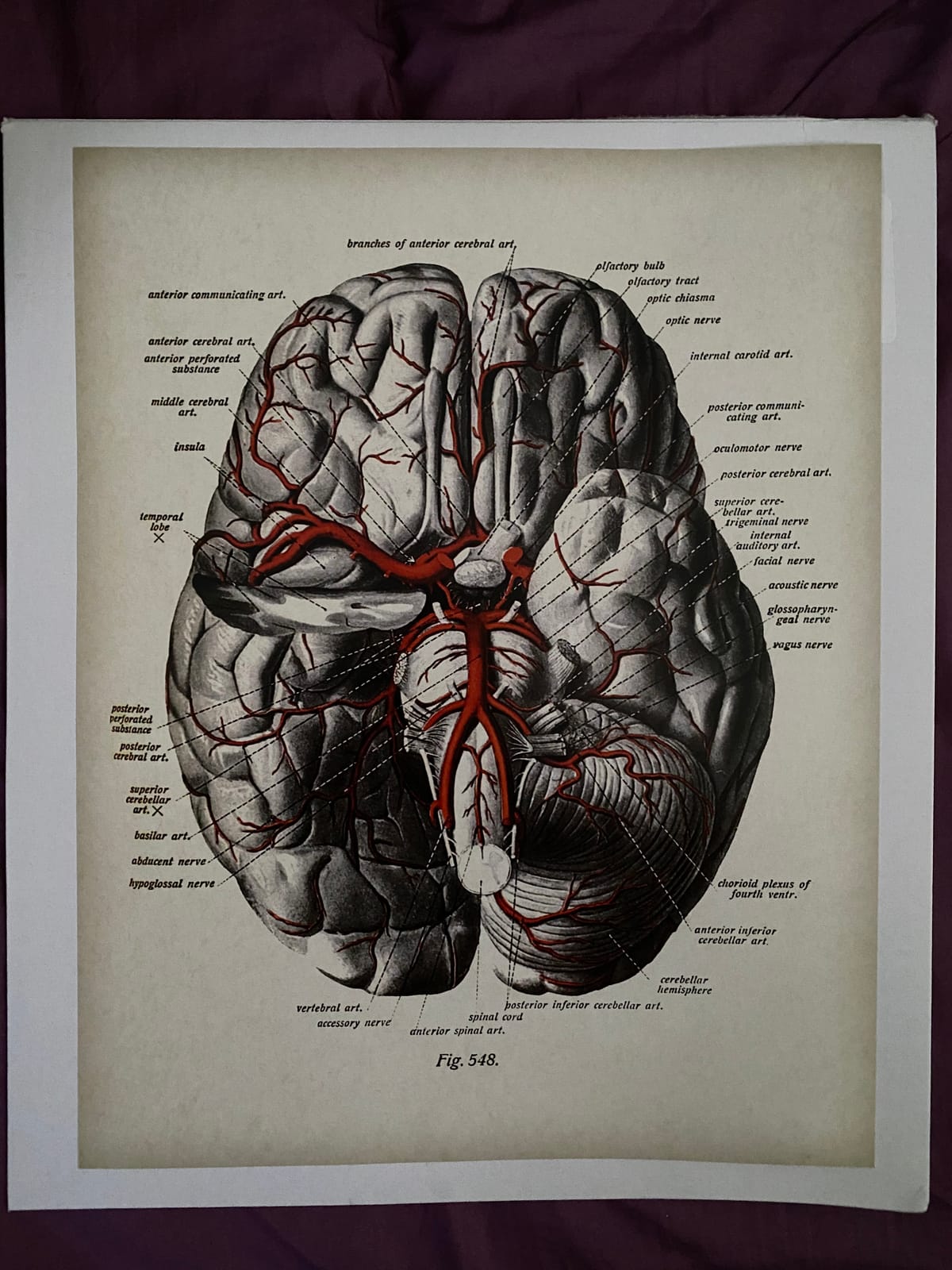 Brain with Blood Vessels and Nerves Anatomy 11x14 Unframed Print – Medical Illustration, Brain Poster, Neuroanatomy Vintage Artwork, Educational Brain Diagram for Office, Clinic & Classroom Décor customer photo 2