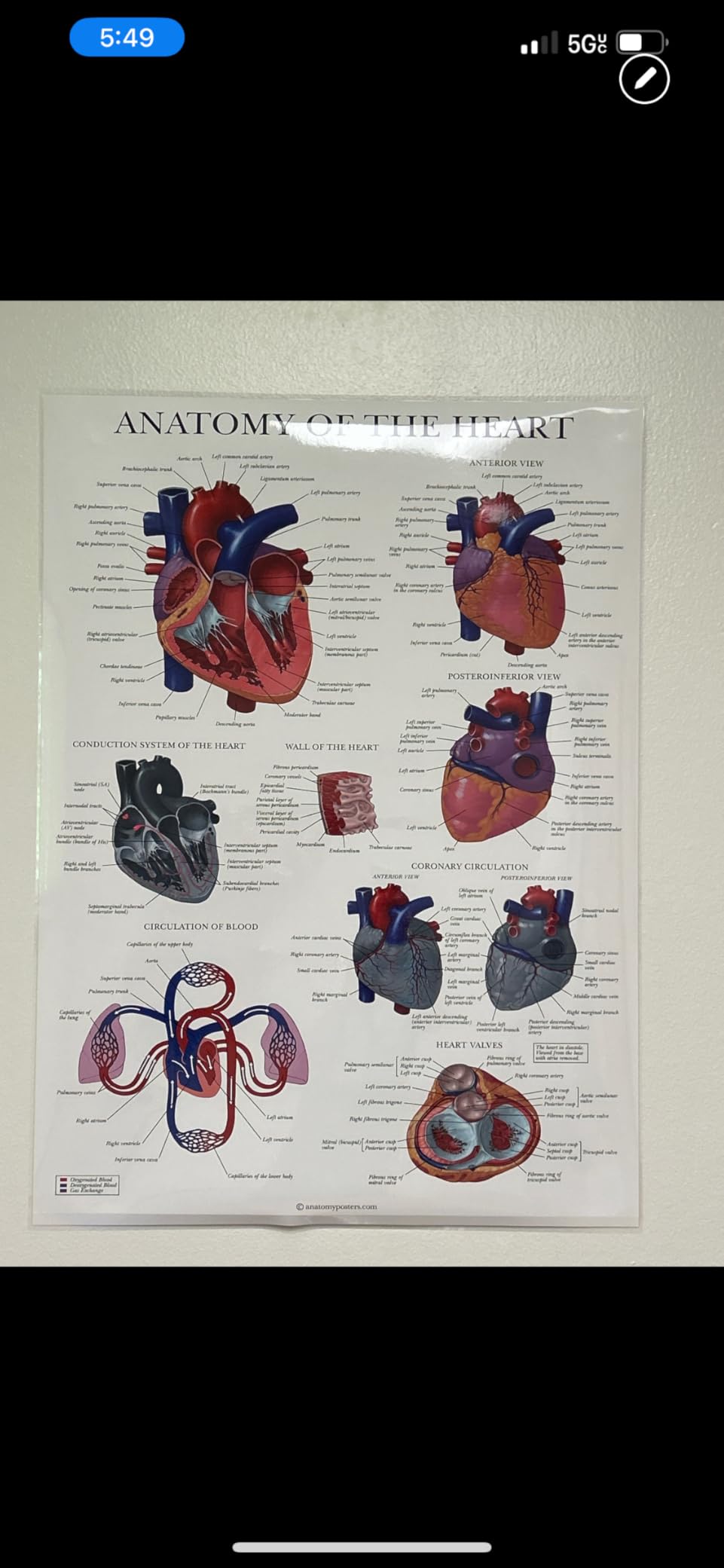 Palace Learning Heart Anatomy Poster - LAMINATED - Anatomical Chart of the Human Heart - 18