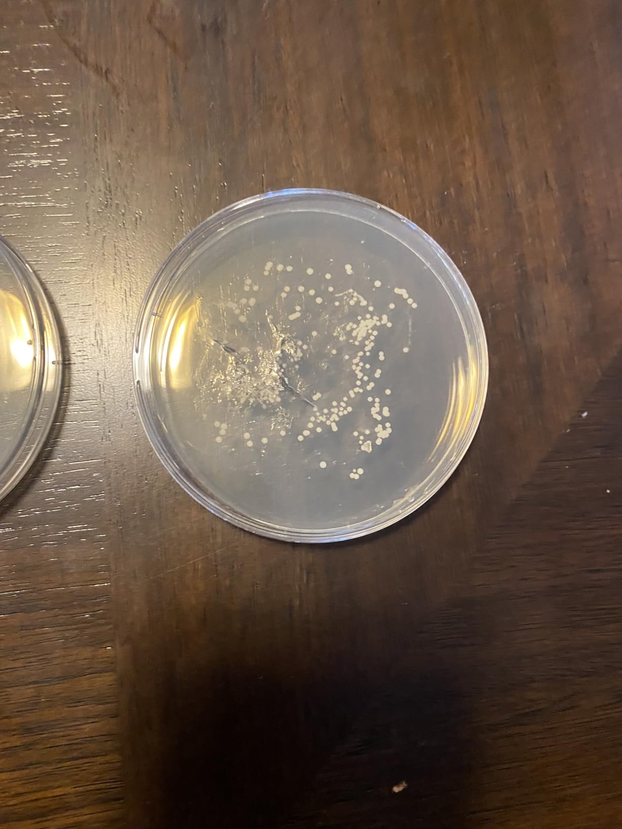 Bacteria Science Kit Petri Dishes with Agar and Swabs | Top Science Fair Project Bacteria Growing Kit | Prepoured LB-Agar Plates and Cotton Swabs | STEM for Kids Aged 6 7 8 9 10 Girls Boys Gifts customer photo 1