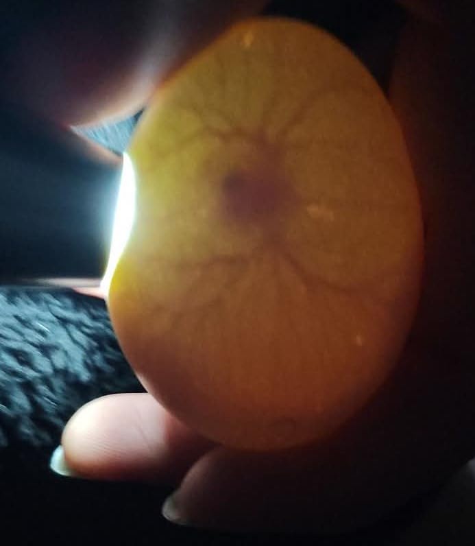 Egg Candler for Chicken Eggs, Rechargeable USB Egg Candling Light customer photo 1