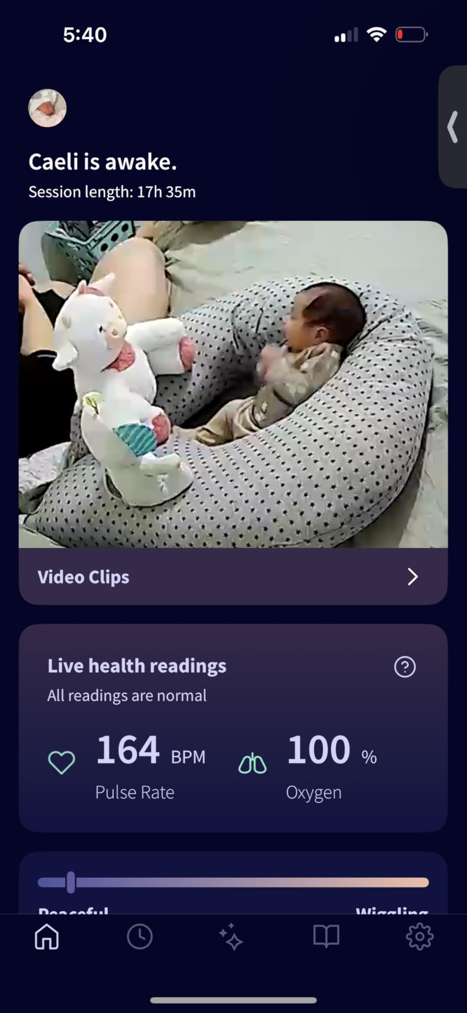 Owlet Dream Duo 2 Smart Baby Monitor System, Camera & Sock customer photo 1