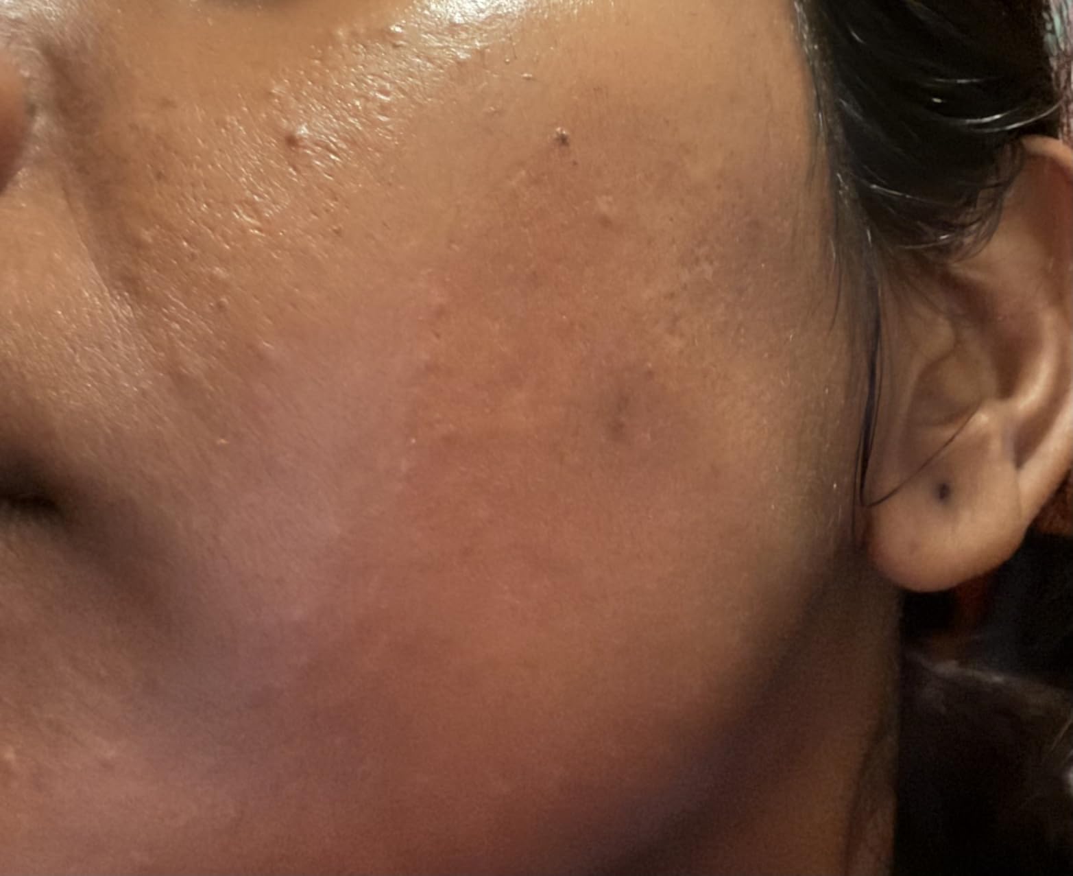 Cicaplast Balm B5 customer photo 1