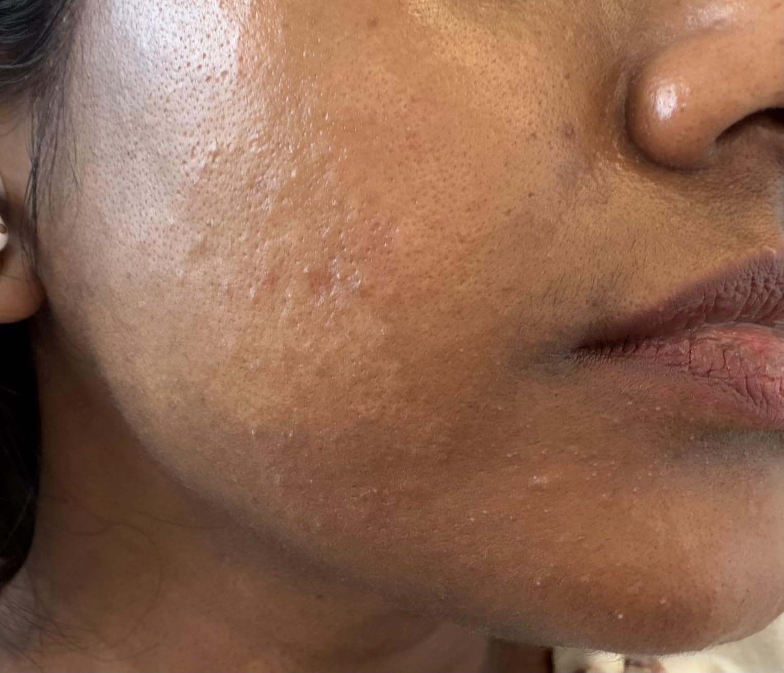 Cicaplast Balm B5 customer photo 2