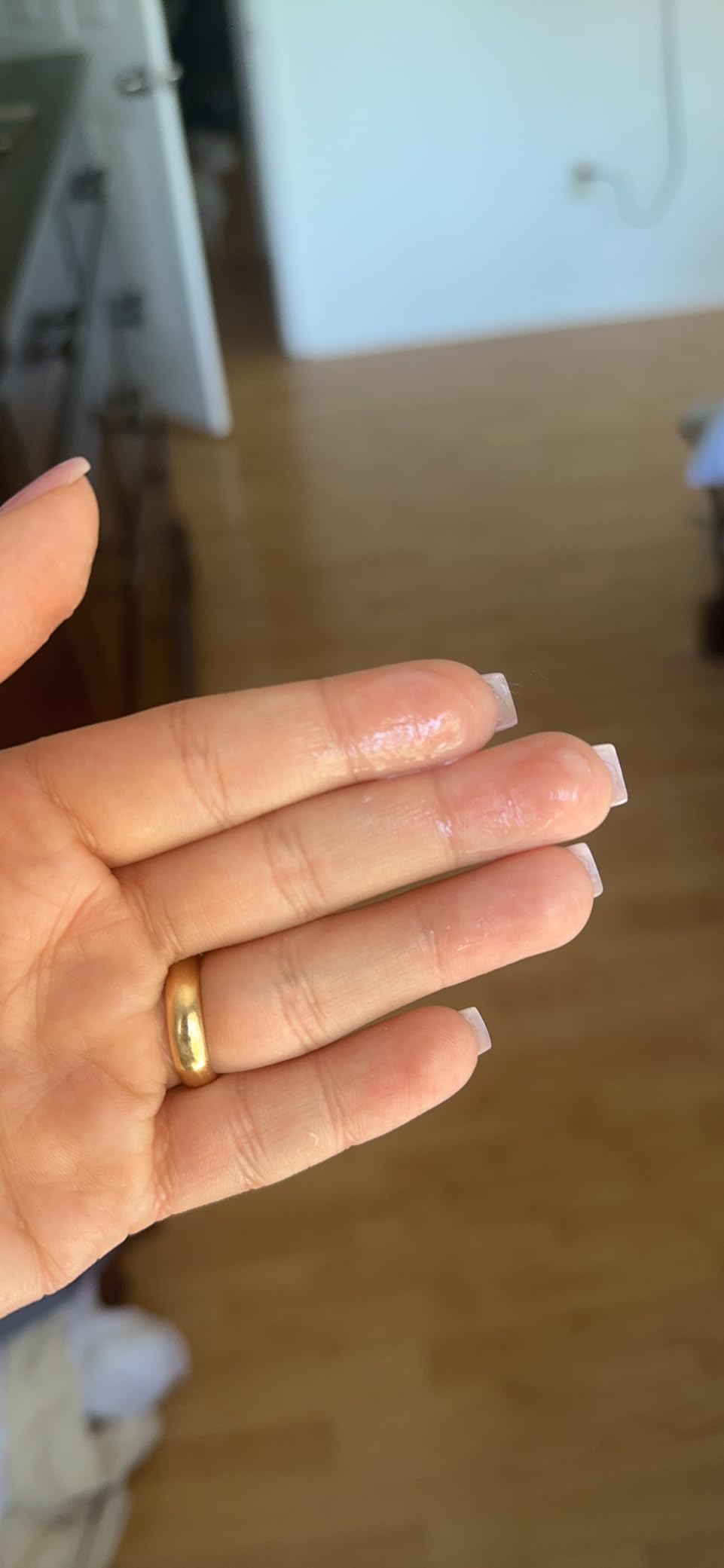 COSRX Oil Free Lotion with Birch Sap, Acne Facial Moisturizer, 3.38 fl oz customer photo 2