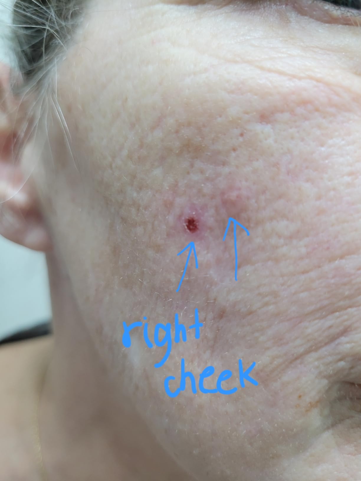 CeraVe Resurfacing Retinol Face Serum with Niacinamide, Pore Minimizer, 1oz customer photo 1