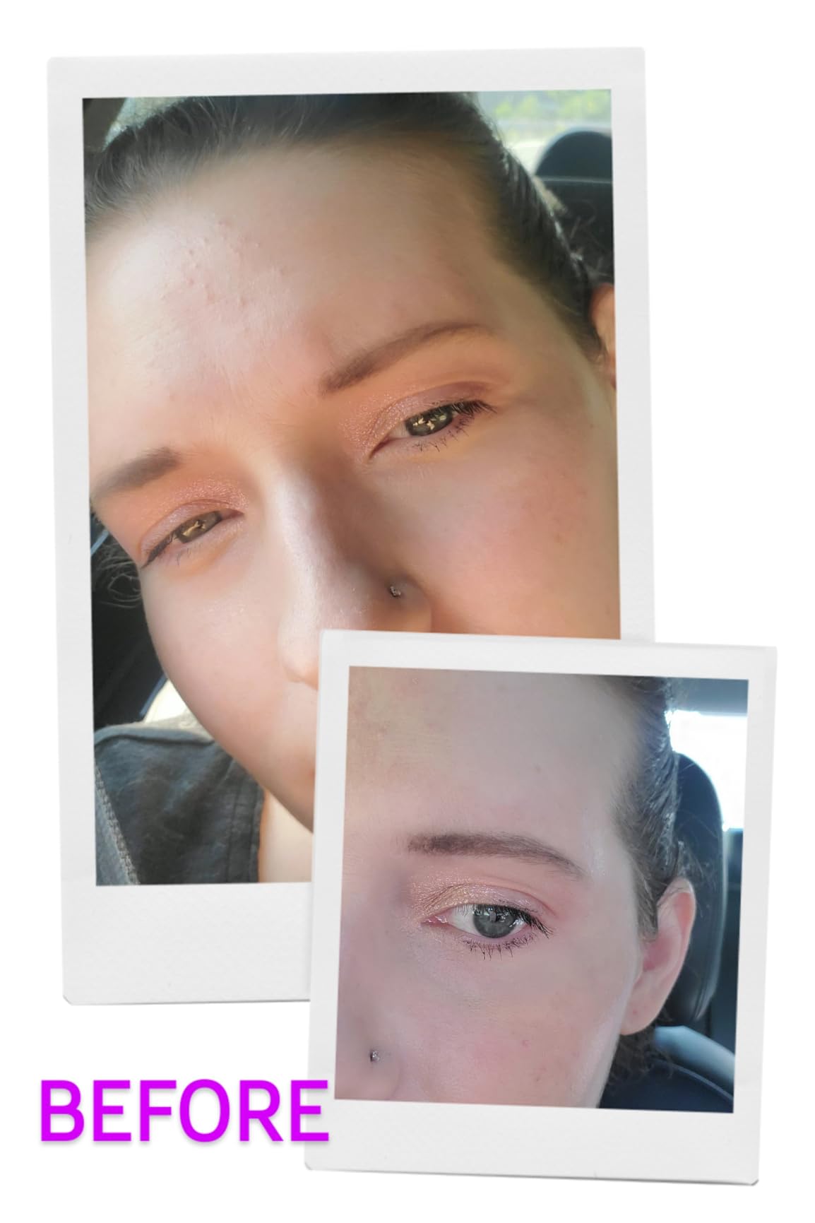 CeraVe Resurfacing Retinol Face Serum with Niacinamide, Pore Minimizer, 1oz customer photo 2