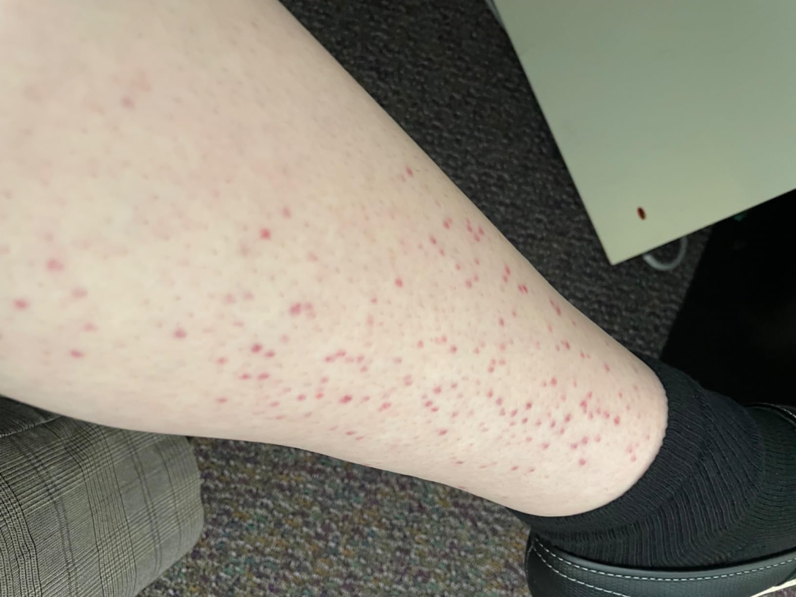 Braun IPL, Silk·Expert Pro 5, IPL Hair Removal for Women and Men, Permanent Laser Hair Reduction At-Home, 4 Heads, IPL5347 customer photo 2