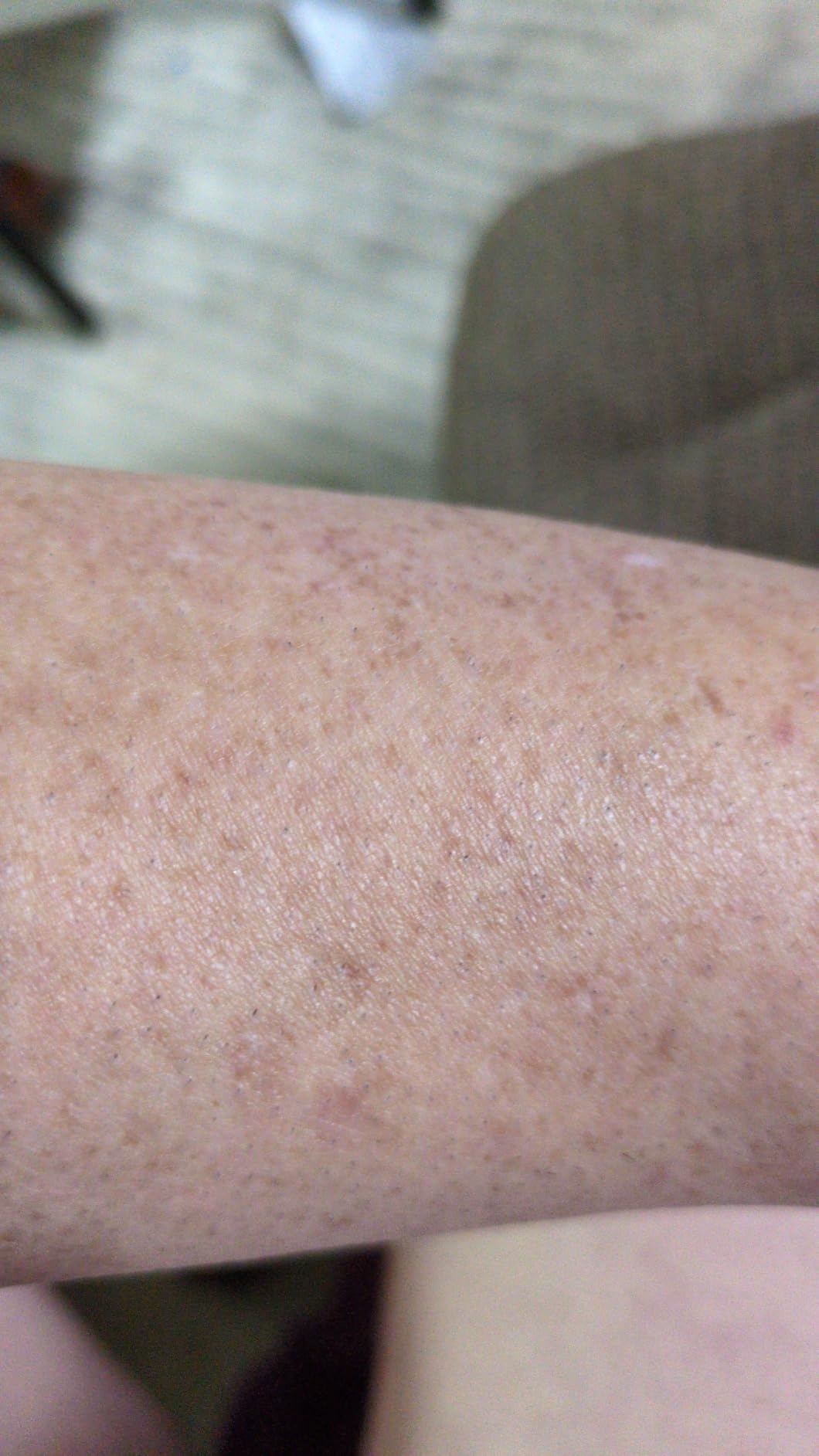 Nood™ Flasher Pro | IPL Laser Hair Removal Device, Forbes Best Product 2026 customer photo 1